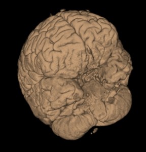 Resultado del VR con texturas 3D / 3D Texture VR Result