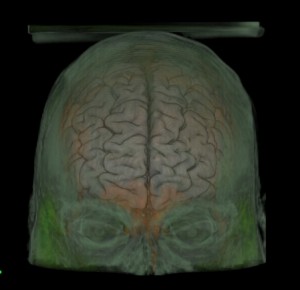 Screenshot del rendering de 4 volúmenes / 4-volume Rendering Screenshot