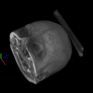 Ejemplo de Volume Rendering / Volume Rendering Example