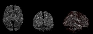 Rendering del volumen de materia blanca con raycasting / White Matter Volume Rendering with raycasting